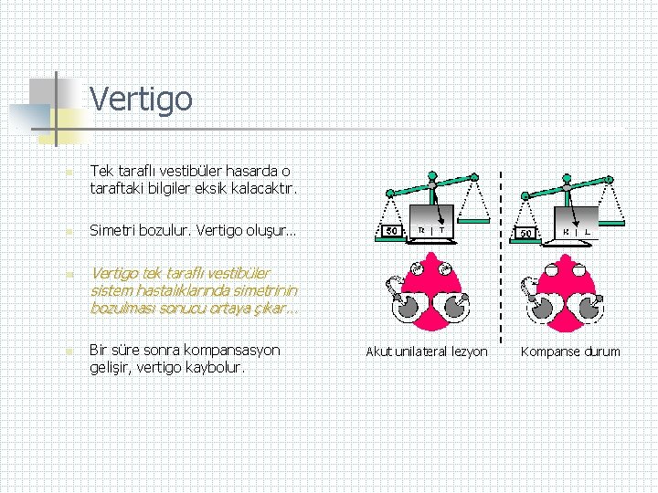 Vertigo n n Tek taraflı vestibüler hasarda o taraftaki bilgiler eksik kalacaktır. Simetri bozulur.