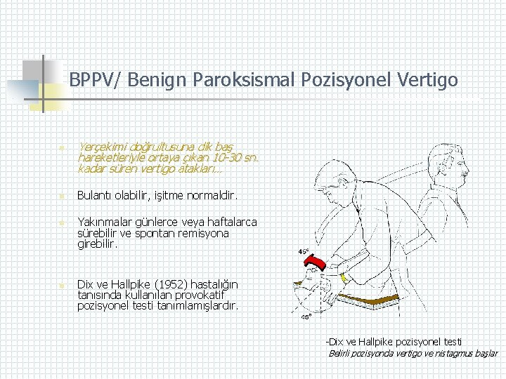 BPPV/ Benign Paroksismal Pozisyonel Vertigo n n Yerçekimi doğrultusuna dik baş hareketleriyle ortaya çıkan