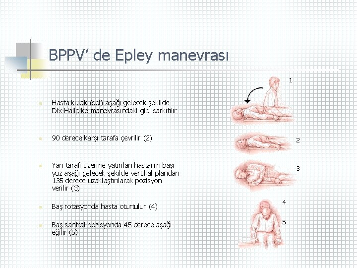 BPPV’ de Epley manevrası 1 n n n Hasta kulak (sol) aşağı gelecek şekilde
