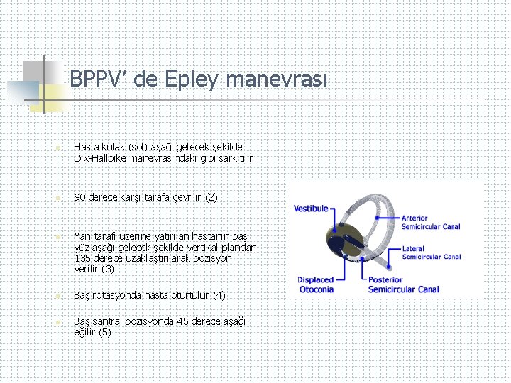 BPPV’ de Epley manevrası n n n Hasta kulak (sol) aşağı gelecek şekilde Dix-Hallpike