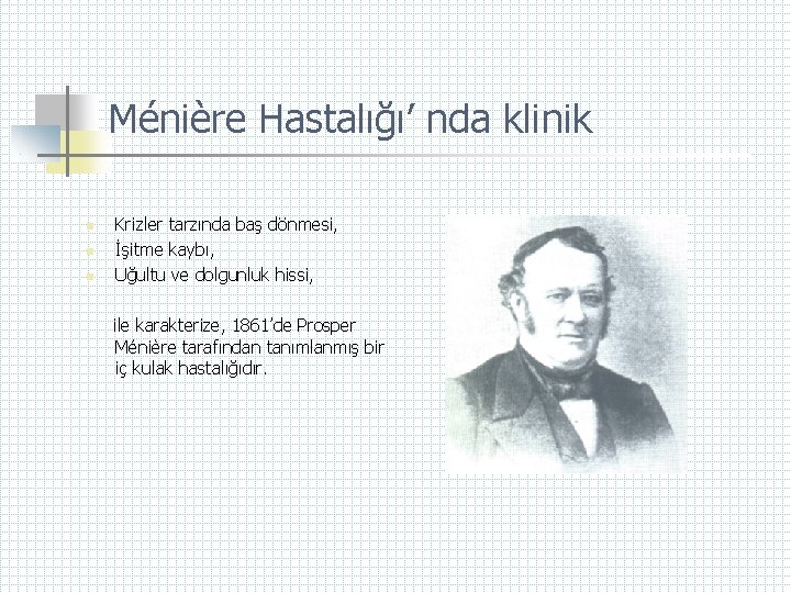 Ménière Hastalığı’ nda klinik n n n Krizler tarzında baş dönmesi, İşitme kaybı, Uğultu
