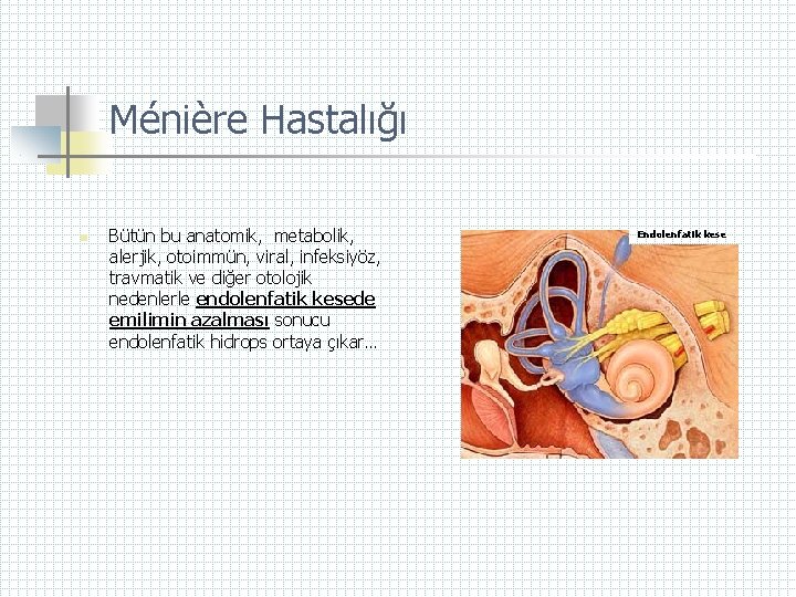 Ménière Hastalığı n Bütün bu anatomik, metabolik, alerjik, otoimmün, viral, infeksiyöz, travmatik ve diğer