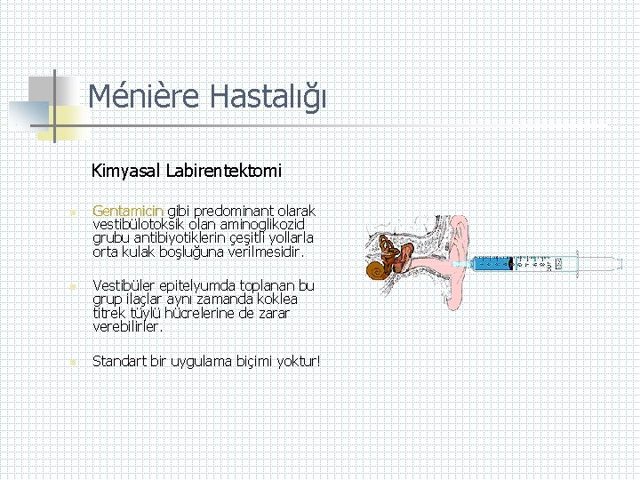 Ménière Hastalığı Kimyasal Labirentektomi n n n Gentamicin gibi predominant olarak vestibülotoksik olan aminoglikozid