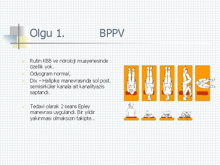 Olgu 1. n n BPPV Rutin KBB ve nöroloji muayenesinde özellik yok. Odyogram normal,
