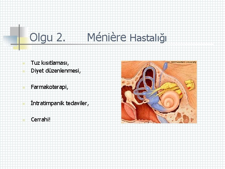 Olgu 2. Ménière Hastalığı n Tuz kısıtlaması, Diyet düzenlenmesi, n Farmakoterapi, n İntratimpanik tedaviler,