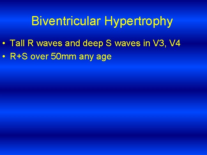 Biventricular Hypertrophy • Tall R waves and deep S waves in V 3, V