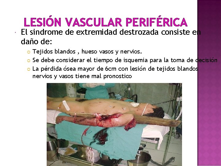 LESIÓN VASCULAR PERIFÉRICA El sindrome de extremidad destrozada consiste en daño de: Tejidos blandos