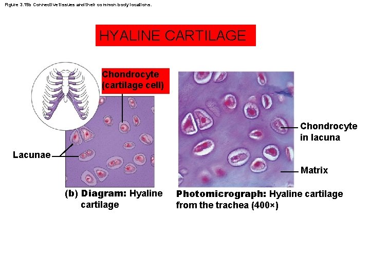 Figure 3. 19 b Connective tissues and their common body locations. HYALINE CARTILAGE Chondrocyte