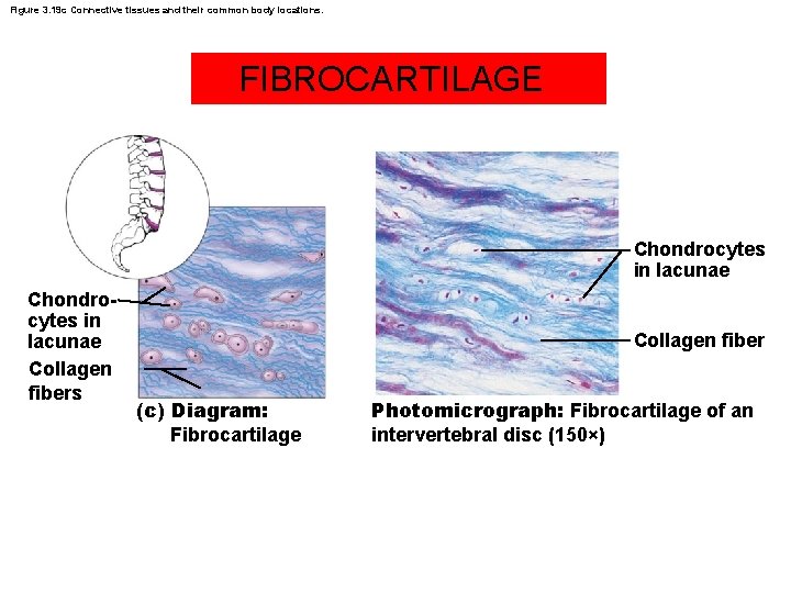 Figure 3. 19 c Connective tissues and their common body locations. FIBROCARTILAGE Chondrocytes in