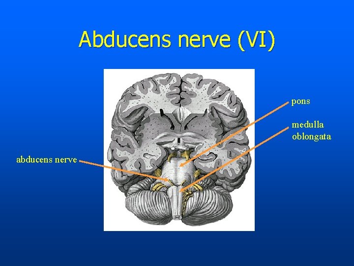 Abducens nerve (VI) pons medulla oblongata abducens nerve 