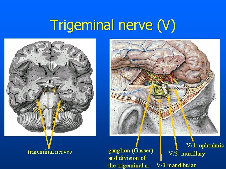 Trigeminal nerve (V) trigeminal nerves V/1: ophtalmic V/2: maxillary ganglion (Gasser) and division of