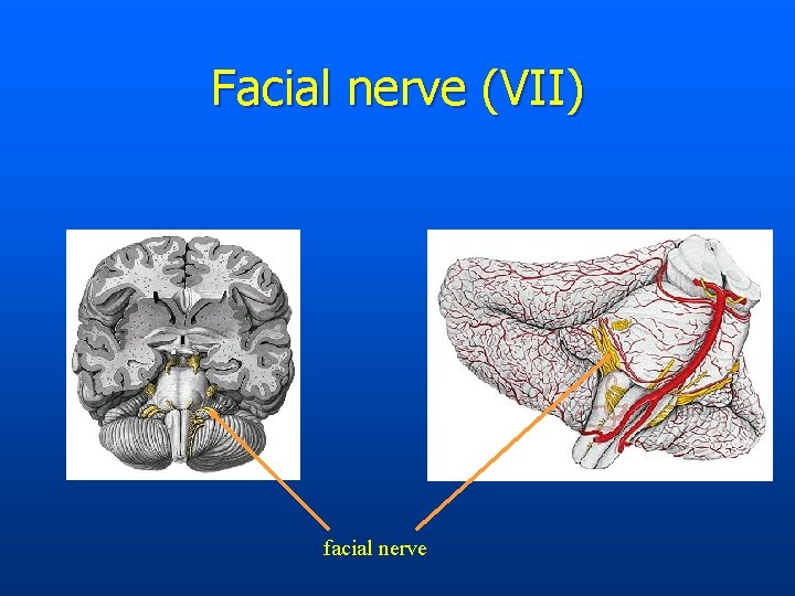 Facial nerve (VII) facial nerve 