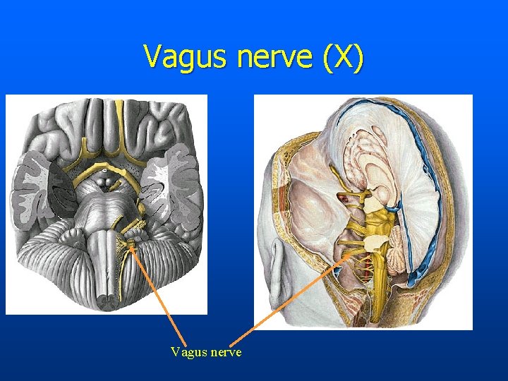 Vagus nerve (X) Vagus nerve 