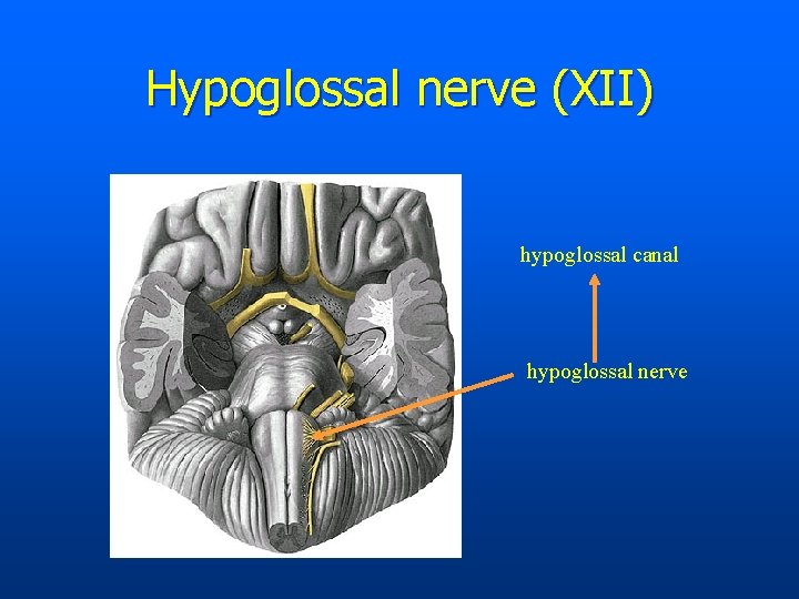 Hypoglossal nerve (XII) hypoglossal canal hypoglossal nerve 