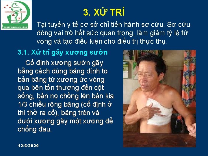 3. XỬ TRÍ Tại tuyến y tế cơ sở chỉ tiến hành sơ cứu.