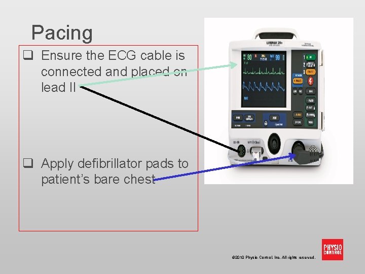 Pacing q Ensure the ECG cable is connected and placed on lead II q