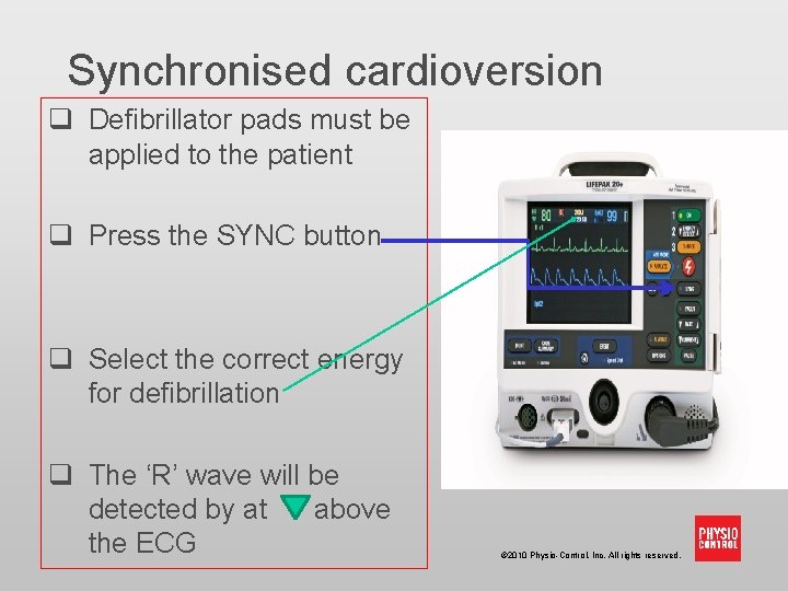 Synchronised cardioversion q Defibrillator pads must be applied to the patient q Press the