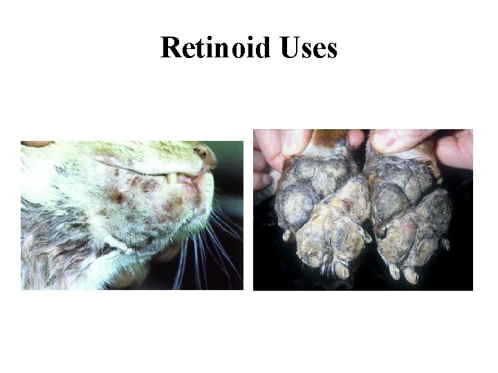 Retinoid Uses 