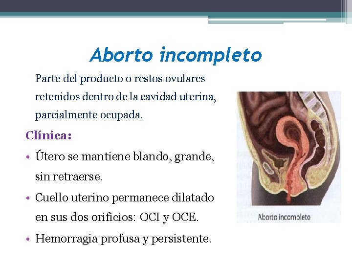 Aborto incompleto Parte del producto o restos ovulares retenidos dentro de la cavidad uterina,