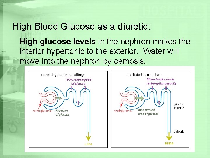 High Blood Glucose as a diuretic: High glucose levels in the nephron makes the