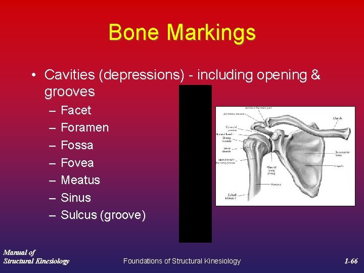 Bone Markings • Cavities (depressions) - including opening & grooves – – – –