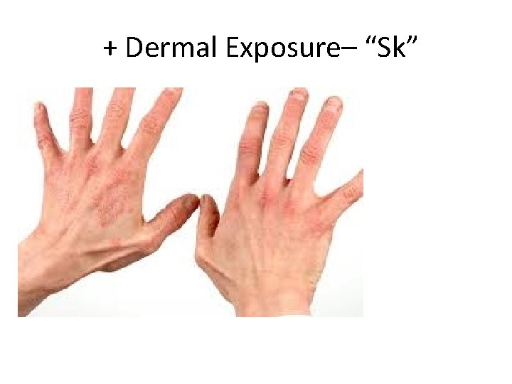 + Dermal Exposure– “Sk” + Dermal Exposure– “Sk”