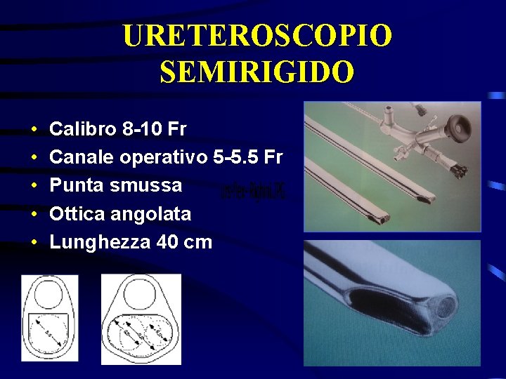 URETEROSCOPIO SEMIRIGIDO • • • Calibro 8 -10 Fr Canale operativo 5 -5. 5