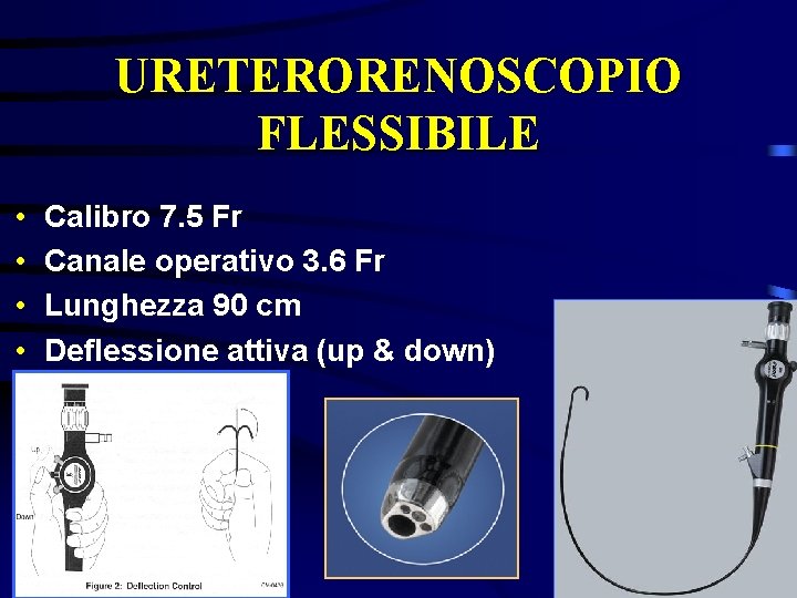 URETERORENOSCOPIO FLESSIBILE • • Calibro 7. 5 Fr Canale operativo 3. 6 Fr Lunghezza