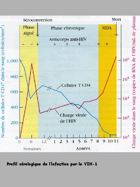 Profil sérologique de l’infection par le VIH-1 