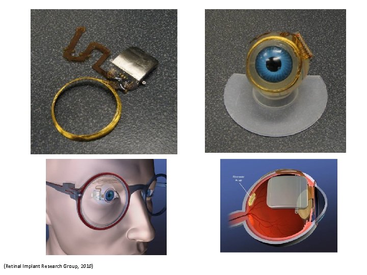 (Retinal Implant Research Group, 2010) (Retinal Implant Research Group, 2010)