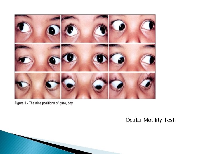 Ocular Motility Test Ocular Motility Test