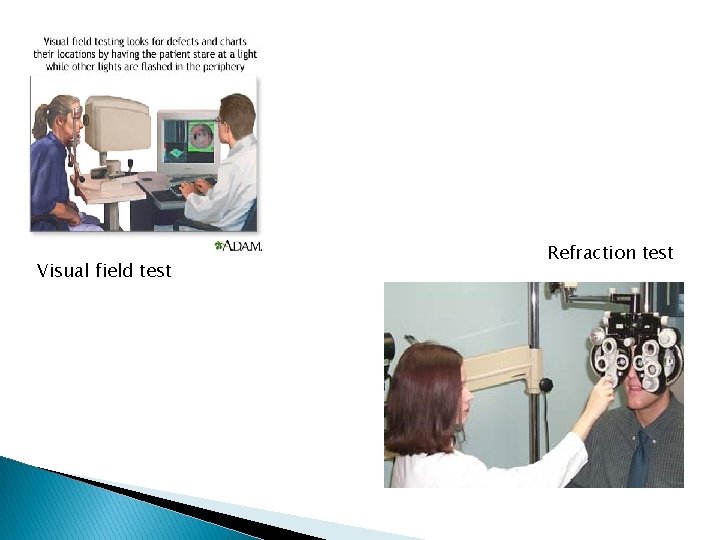 Visual field test Refraction test Visual field test Refraction test