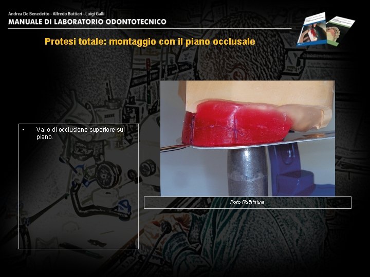 Protesi totale: montaggio con il piano occlusale • Vallo di occlusione superiore sul piano.