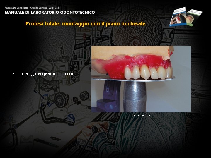 Protesi totale: montaggio con il piano occlusale • Montaggio dei premolari superiori. Foto Ruthinium