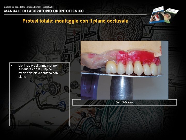 Protesi totale: montaggio con il piano occlusale • Montaggio del primo molare superiore con