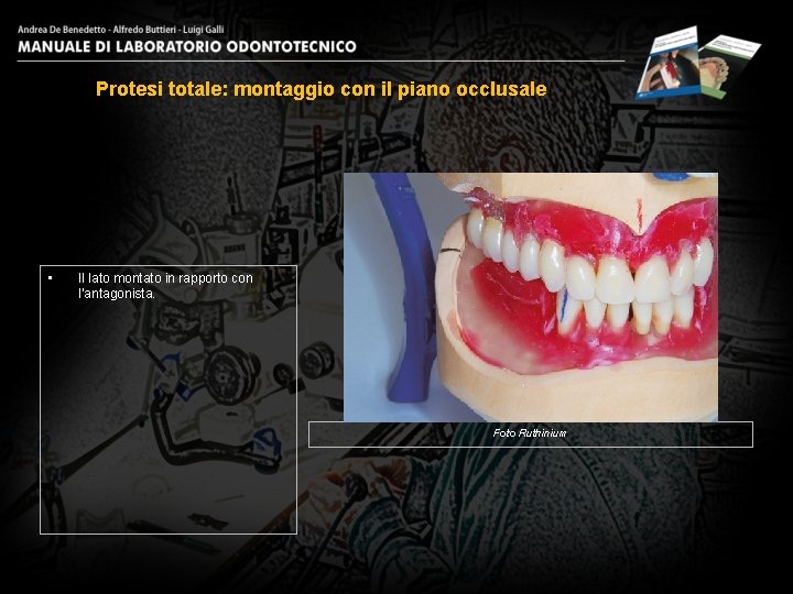 Protesi totale: montaggio con il piano occlusale • Il lato montato in rapporto con