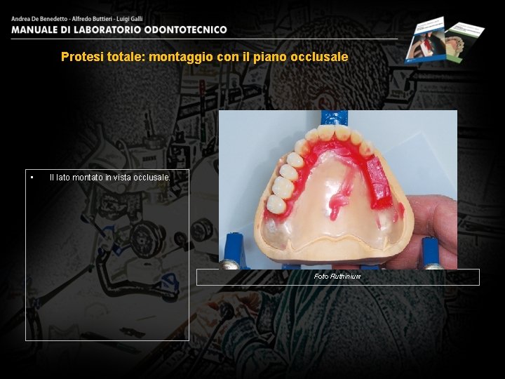 Protesi totale: montaggio con il piano occlusale • Il lato montato in vista occlusale.