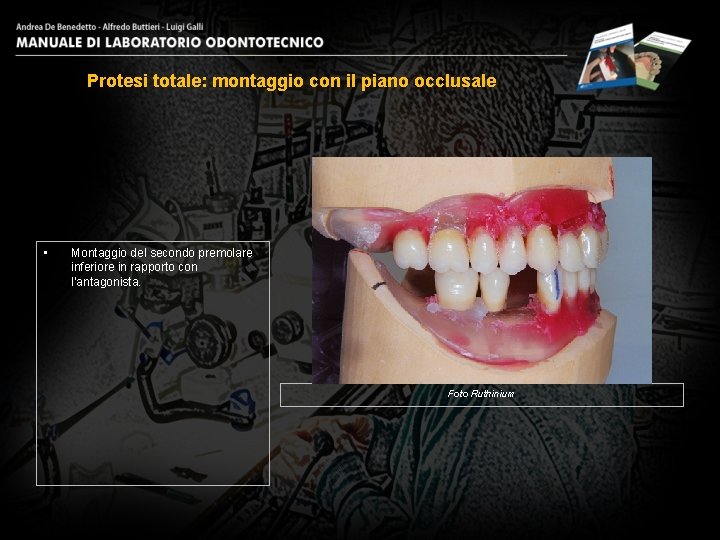 Protesi totale: montaggio con il piano occlusale • Montaggio del secondo premolare inferiore in