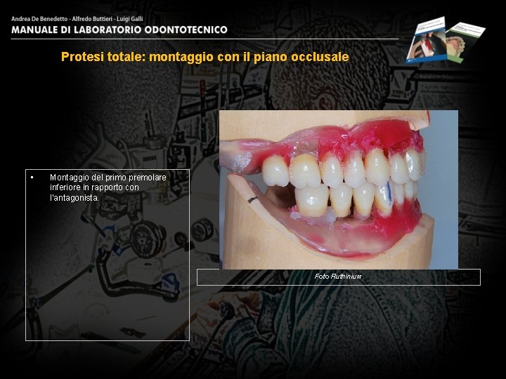 Protesi totale: montaggio con il piano occlusale • Montaggio del primo premolare inferiore in