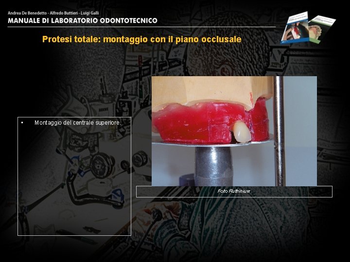Protesi totale: montaggio con il piano occlusale • Montaggio del centrale superiore. Foto Ruthinium