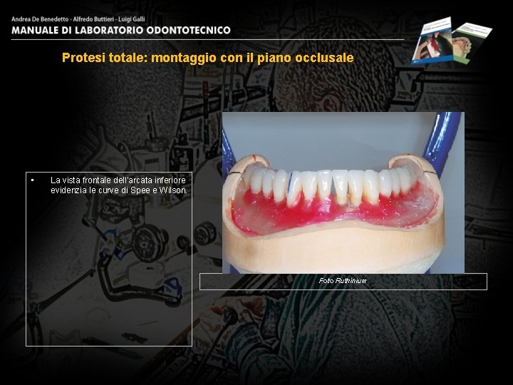 Protesi totale: montaggio con il piano occlusale • La vista frontale dell’arcata inferiore evidenzia