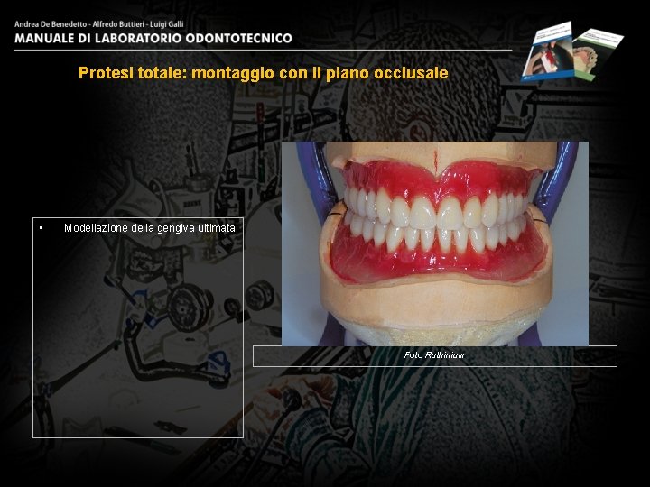 Protesi totale: montaggio con il piano occlusale • Modellazione della gengiva ultimata. Foto Ruthinium