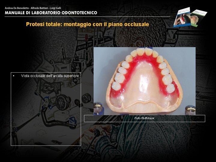 Protesi totale: montaggio con il piano occlusale • Vista occlusale dell’arcata superiore. Foto Ruthinium