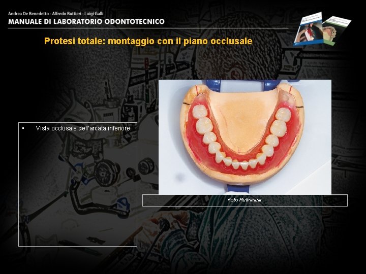 Protesi totale: montaggio con il piano occlusale • Vista occlusale dell’arcata inferiore. Foto Ruthinium