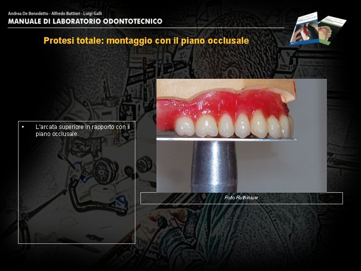 Protesi totale: montaggio con il piano occlusale • L’arcata superiore in rapporto con il