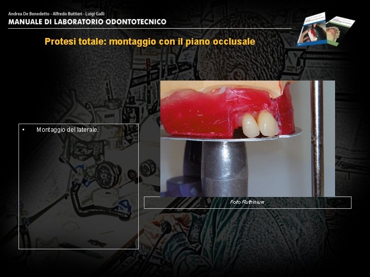 Protesi totale: montaggio con il piano occlusale • Montaggio del laterale. Foto Ruthinium 3