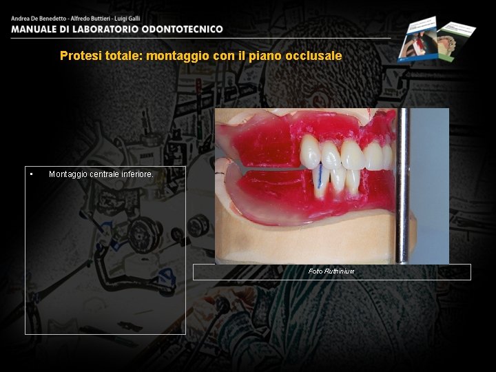 Protesi totale: montaggio con il piano occlusale • Montaggio centrale inferiore. Foto Ruthinium 8