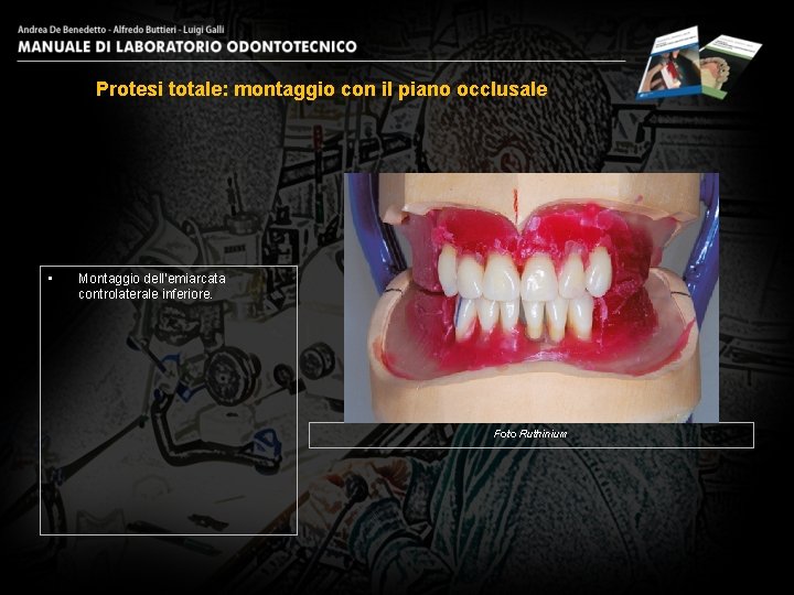 Protesi totale: montaggio con il piano occlusale • Montaggio dell’emiarcata controlaterale inferiore. Foto Ruthinium