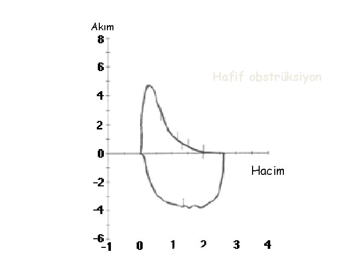 Akım Hafif obstrüksiyon Hacim 