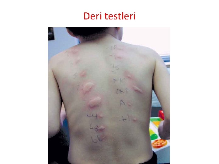 Deri testleri 